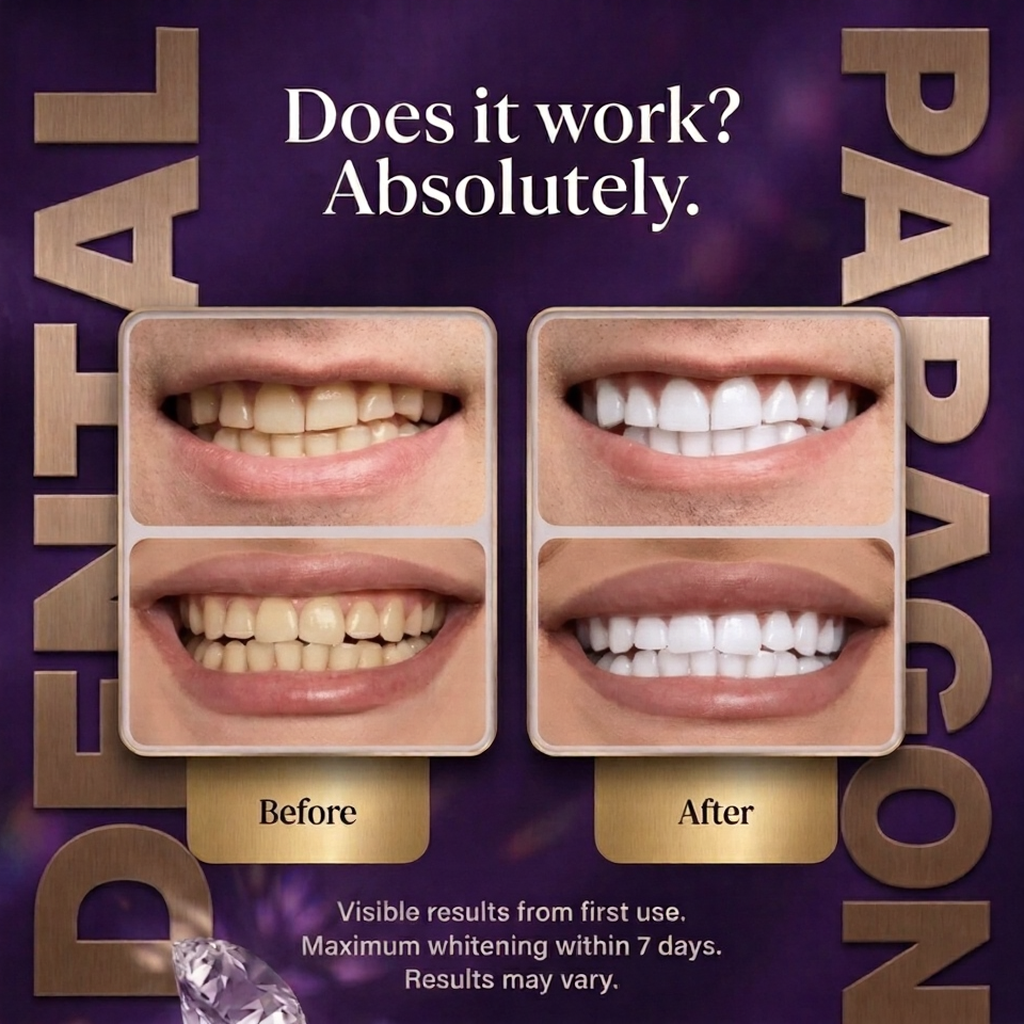 Paragon Dental Purple Teeth Whitening Strips™