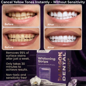 Paragon Dental Purple Teeth Whitening Strips™
