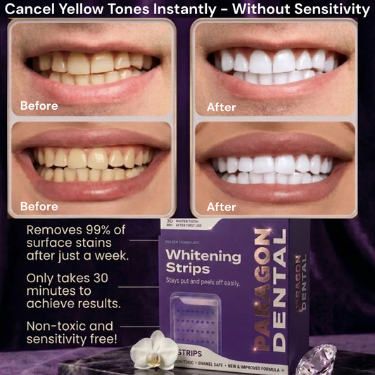 Paragon Dental Purple Teeth Whitening Strips™